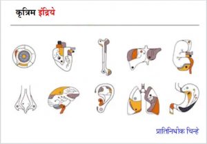 Read more about the article कृत्रिम इंद्रिये (Artificial organs)