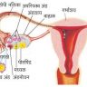 अंडाशय १ (Ovary)