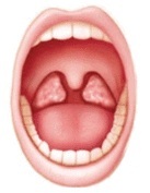 Read more about the article टॉन्सिल (Tonsil)