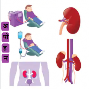 Read more about the article अपोहन (Dialysis)
