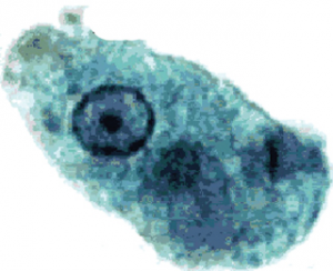अमीबाजन्य विकार (Amoebiasis)