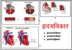 Read more about the article हृदयविकार (Heart disease)