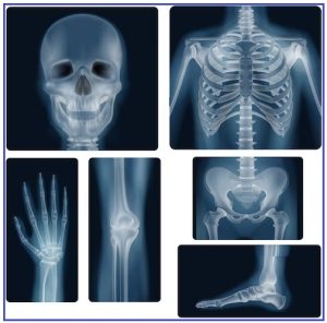 Read more about the article क्ष-किरण : निदान व उपचार (X-ray : Diagnosis and therapy)
