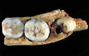 ॲन्टेसेसर मानव (Homo antecessor)